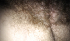 Hairy pussy - N