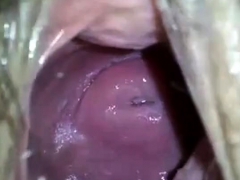 my japanese girlfend's cute cervix in huge hole