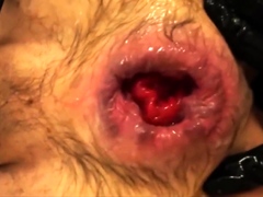 Anal orgasms from fisting